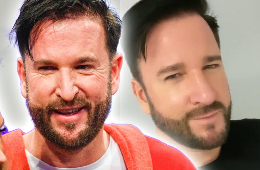 Michael Wendler hat eine neue Nase ...