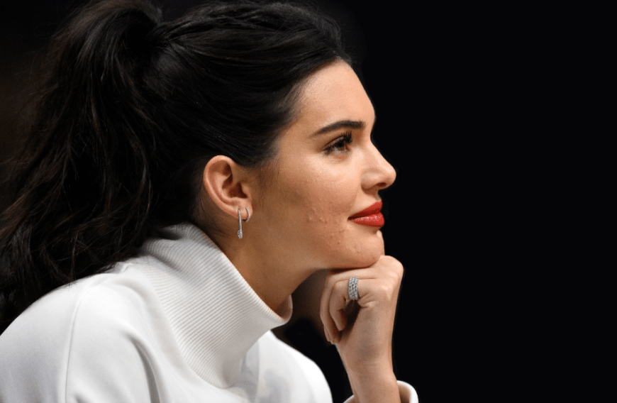 Pickel sind lästig und schmerzhaft. Auch Stars wie Kendall Jenner bleiben nicht verschont.