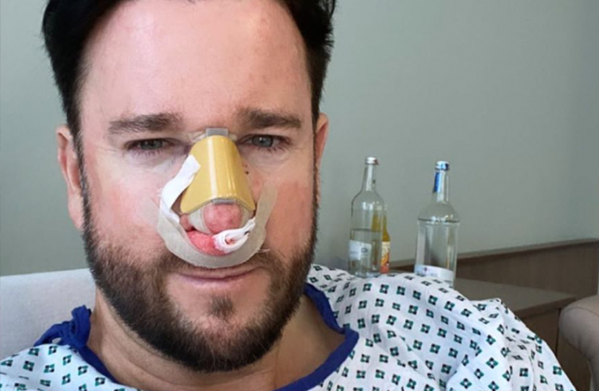Eine Überraschung wäre das wohl nicht, denn immerhin legte sich auch Ehemann Michael Wendler bereits unters Messer. Mit seiner Nasen-OP ging der Schlagerstar aber von Anfang an sehr offen um, wie dieses Selfie eindrucksvoll zeigt.