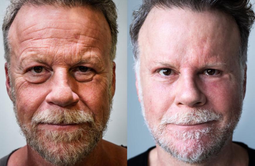 Das Experiment artete zu einem wahren Beauty-Eingriff-Marathon aus. Für die Mutter des TV-Journalisten der absolute Horror!