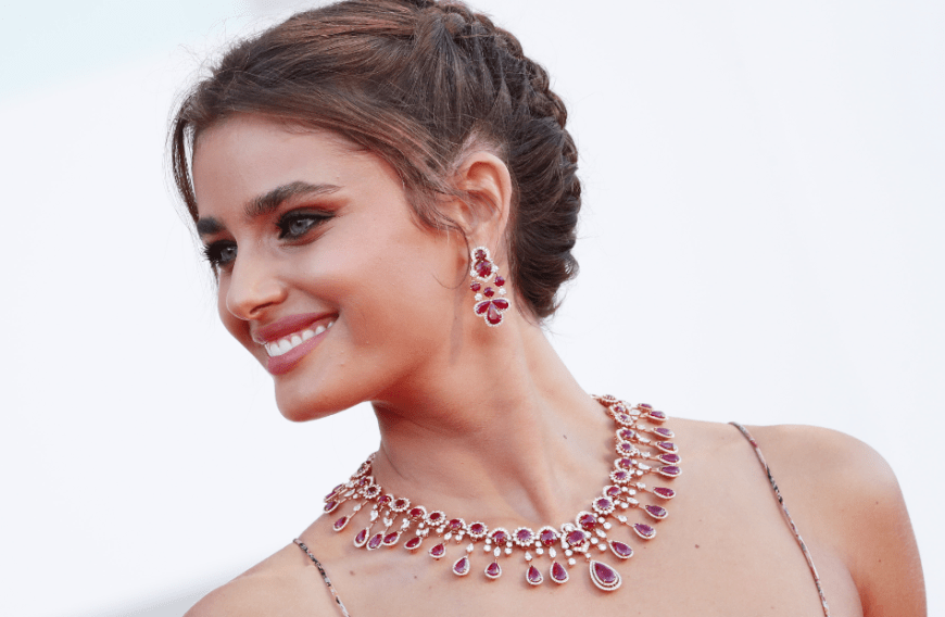 Auch Model Taylor Hill neigt hin und wieder zu unreiner Haut.