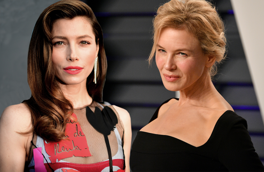 Die Schauspielerinnen Renée Zellweger und Jessica Biel kennen das Problem mit den Schlupflidern ebenfalls ...