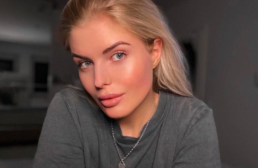 Bei diesem Bild ist es kaum zu glauben, dass Antonia Hemmer lange unter starker Akne litt.