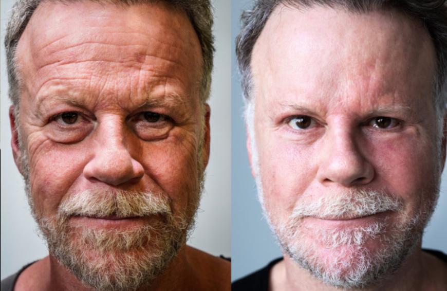 Einer der Gründe: Noch immer sieht das Gesicht des Journalisten extrem verändert aus: Vor einigen Monaten unterzog sich Jenke einem Beauty-Marathon, auf diesem Vorher-Nachher-Bild ist das ganze Ausmaß seiner Schönheits-OPs deutlich zu erkennen.