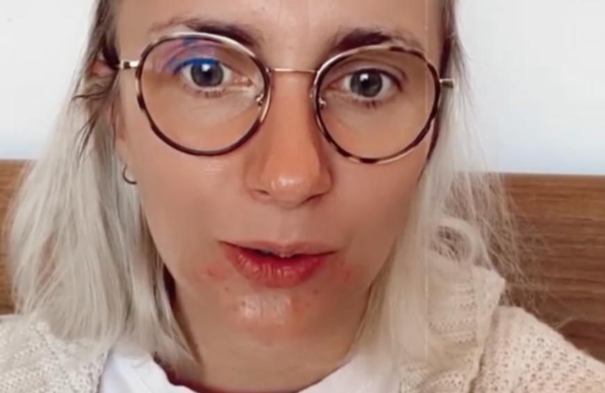 Ein Problem, das die Blondine bis heute begleitet, sind ihre Hormonschwankungen, die in ihrem Fall Akne zur Folge haben.