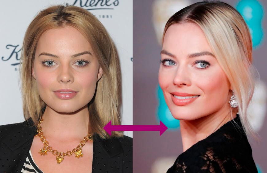 Auch Schauspielerin Margot Robbie ließ sich die Nase operativ verschmälern.
Noch mehr Infos zum Thema Beauty-Treatments und Co. findest du in der aktuellen OK! – jeden Mittwoch neu am Kiosk erhältlich!