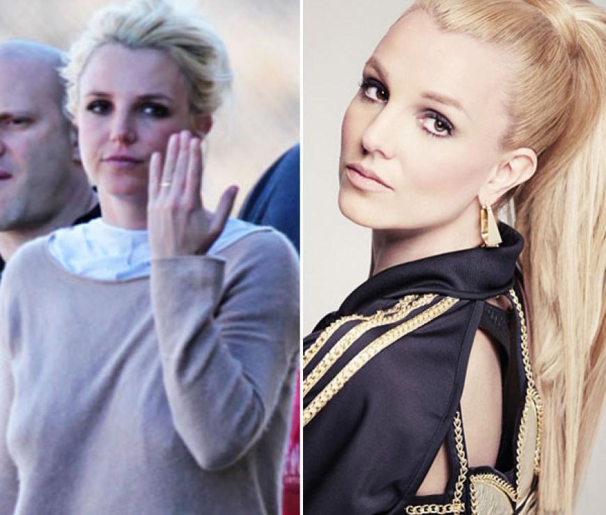 Jaja, von wegen makellose Haut und volles, langes Haar. Auch Britney hat privat einige Problemzonen ... Puuhh!