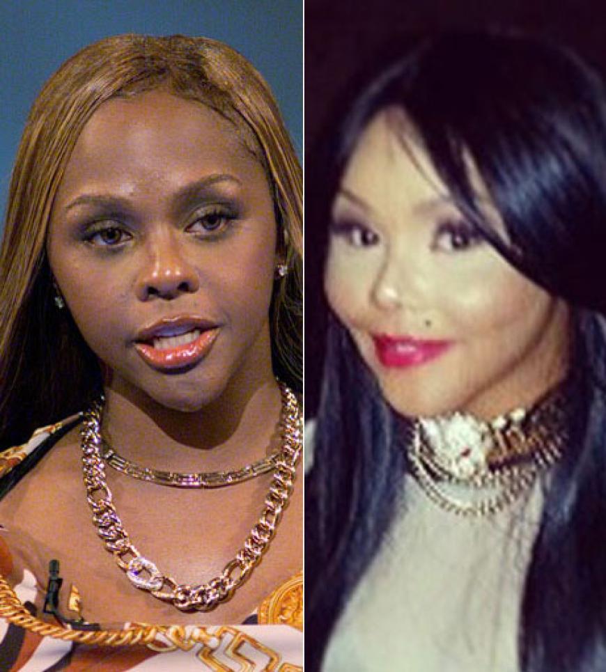 Lil' Kim's Gesicht ist wegen unzähliger Schönheits-OP's nicht mehr wiederzuerkennen