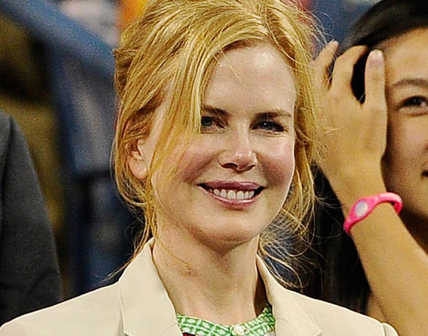 Huch, Hollywood-Star Nicole Kidman zeigte sich fast ungeschminkt!