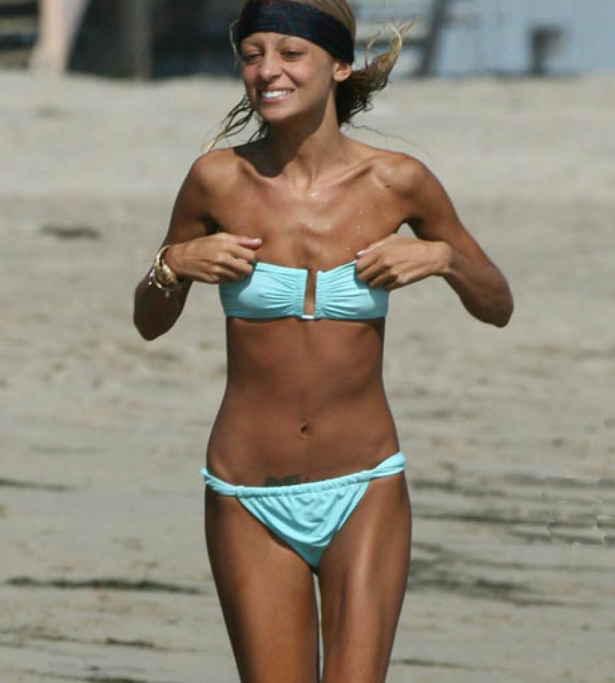 Schock! Stars wie Nicole Richie magern sich hässlich