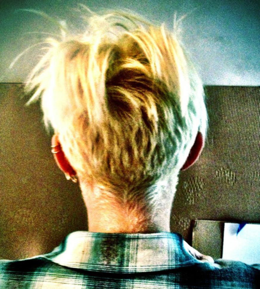 Auch am Hinterkopf hat sie Haare gelassen