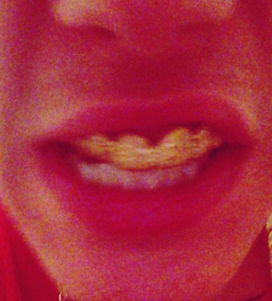Bieber läuft seit einiger Zeit mit Grillz durch die Gegend. Der Teenie macht mal wieder auf bösen Gangster. Apropos Gangster!