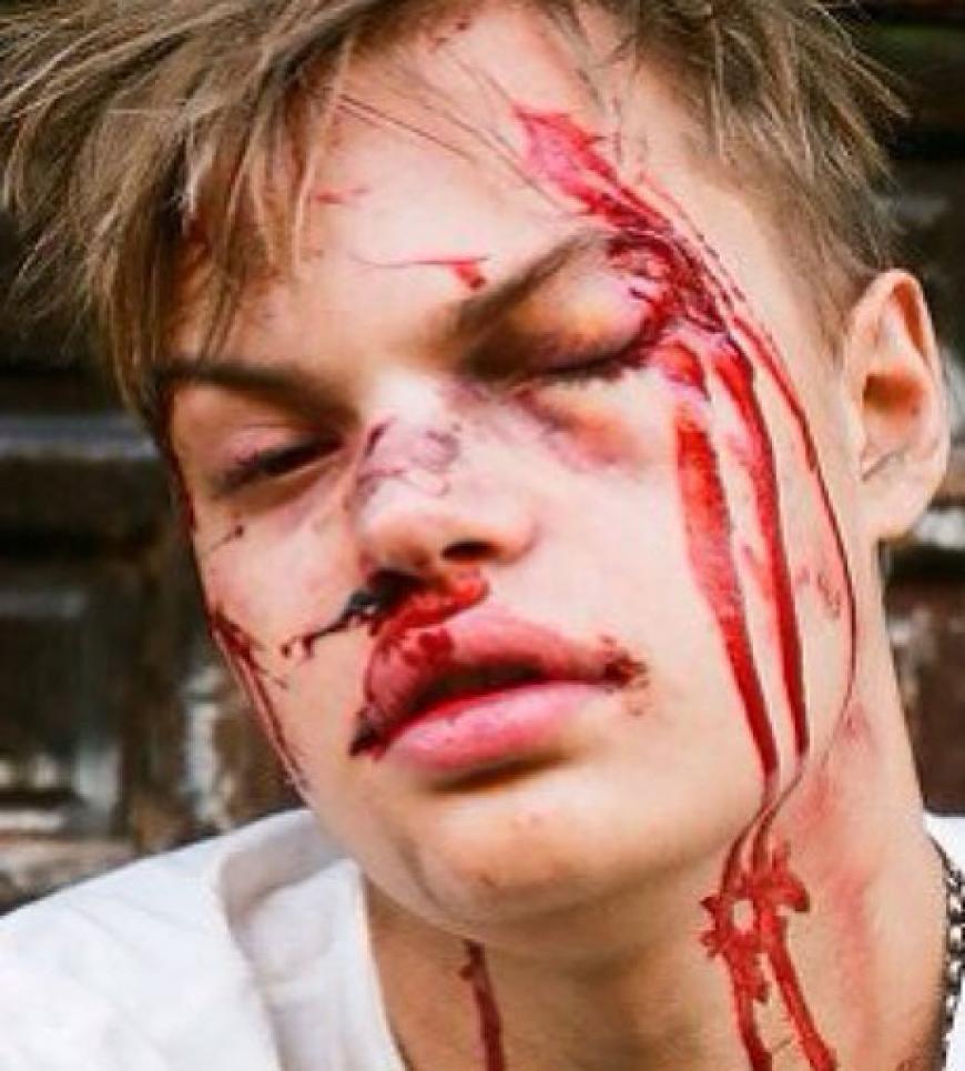 Blutüberströmt blinzelt der 23-jährige Jungschauspieler in die Kamera