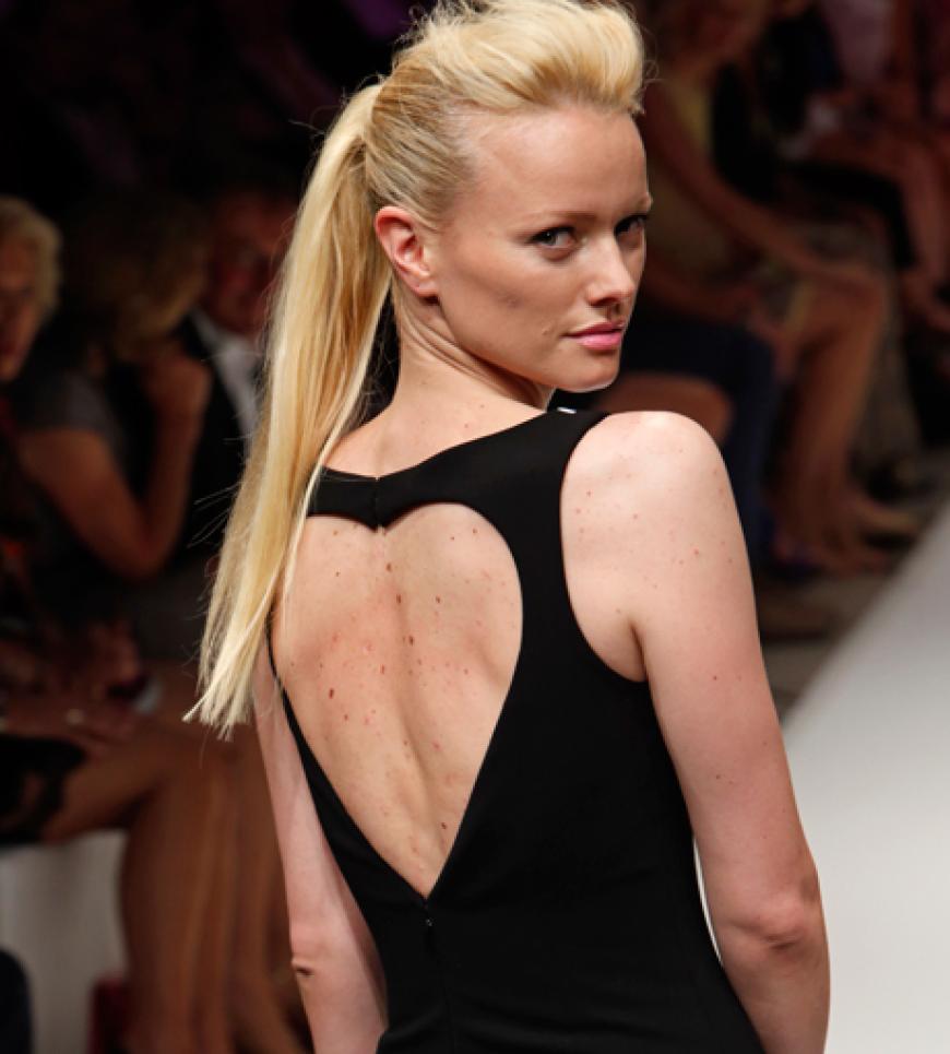 Franziska Knuppe für Basler