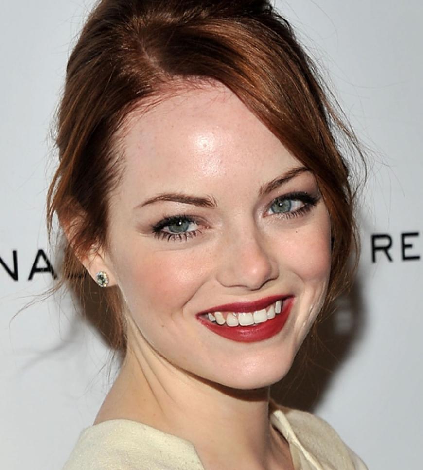 Hübsch: Schauspielerin Emma Stone