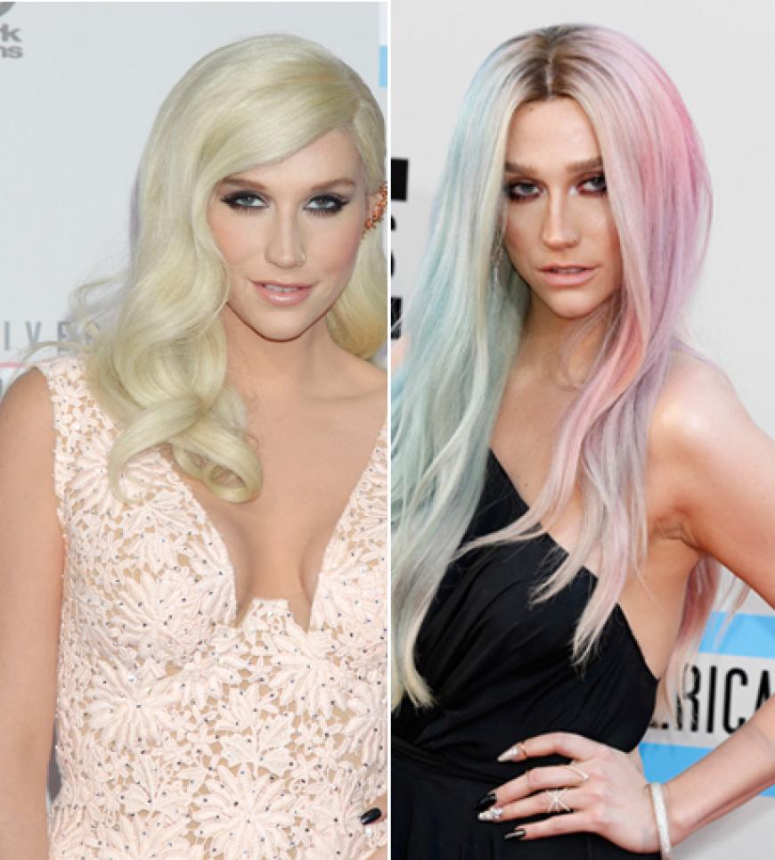 Sängerin Ke$ha im Frühjahr (l.) und im November 2013. Im Januar 2014 wird bekannt, dass sie sich wegen Magersucht und Bulimie in einer Klinik behandeln lässt