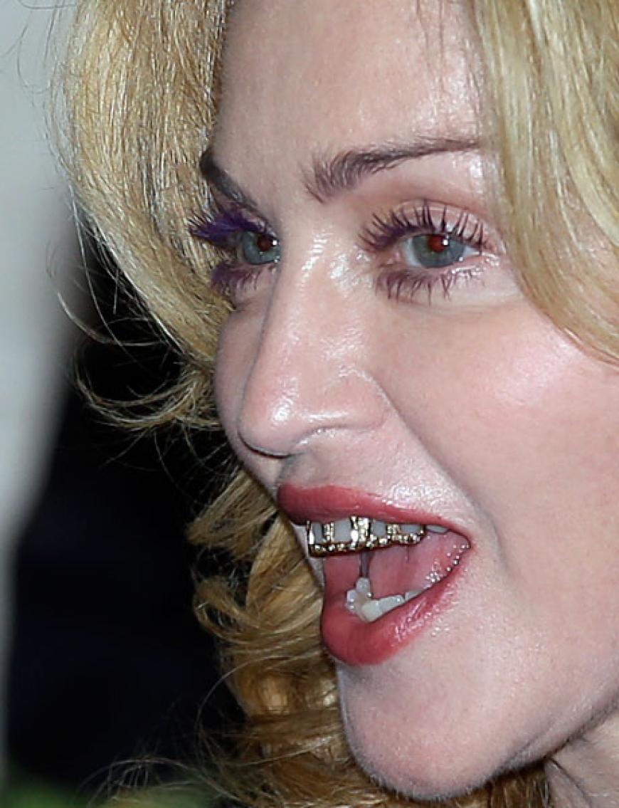 Und auch die Popqueen hat sich ihre Zähne vergolden lassen. Zumindest trägt Madonna damit auf einen aktuellen Promi-Trend auf: Grillz ist offensichtlich das neue Must-Have