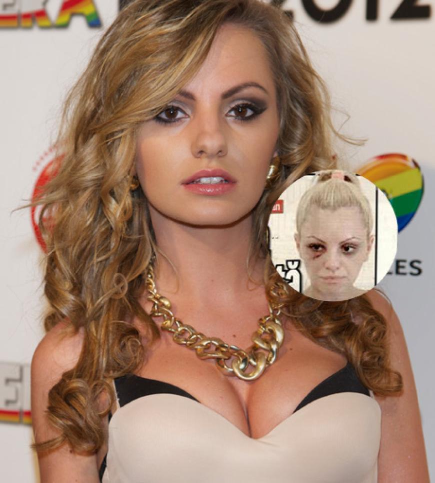 Alexandra Stan soll von Marcel Prodan so übel verprügelt worden sein