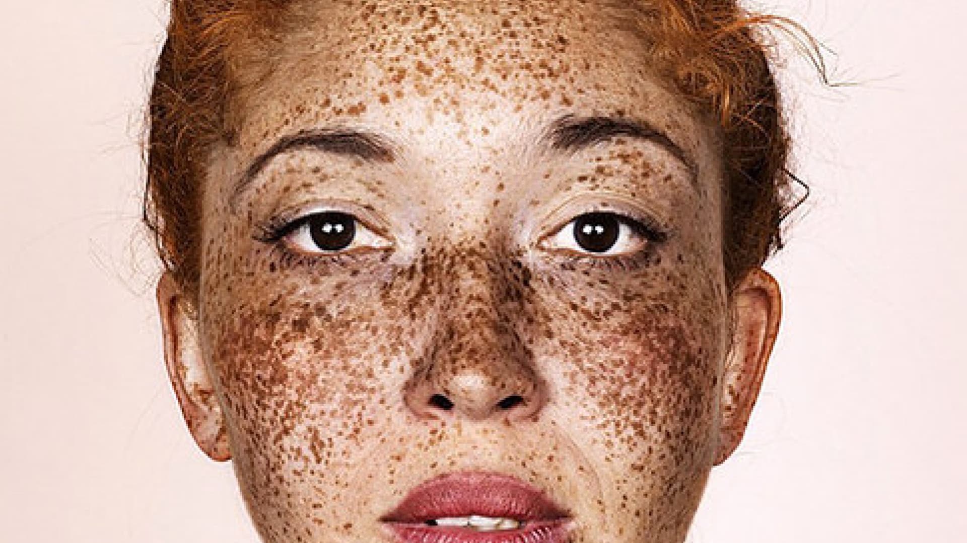 Freckles Dieser Fotograf zeigt, wie schön Sommersprossen sind OK! Magazin Freckles Dieser Fotograf zeigt, wie schön Sommersprossen sind OK! Magazin
