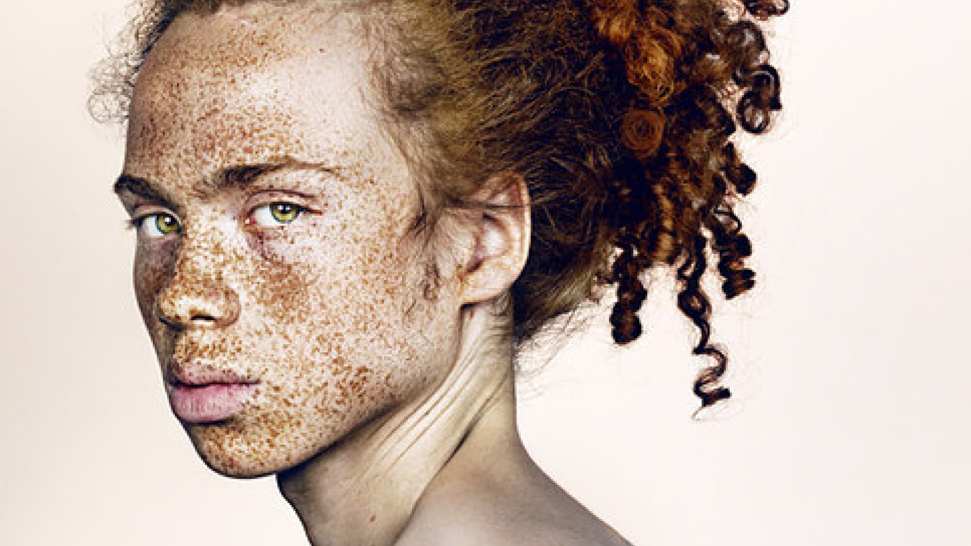 Freckles Dieser Fotograf zeigt, wie schön Sommersprossen sind OK! Magazin Freckles Dieser Fotograf zeigt, wie schön Sommersprossen sind OK! Magazin
