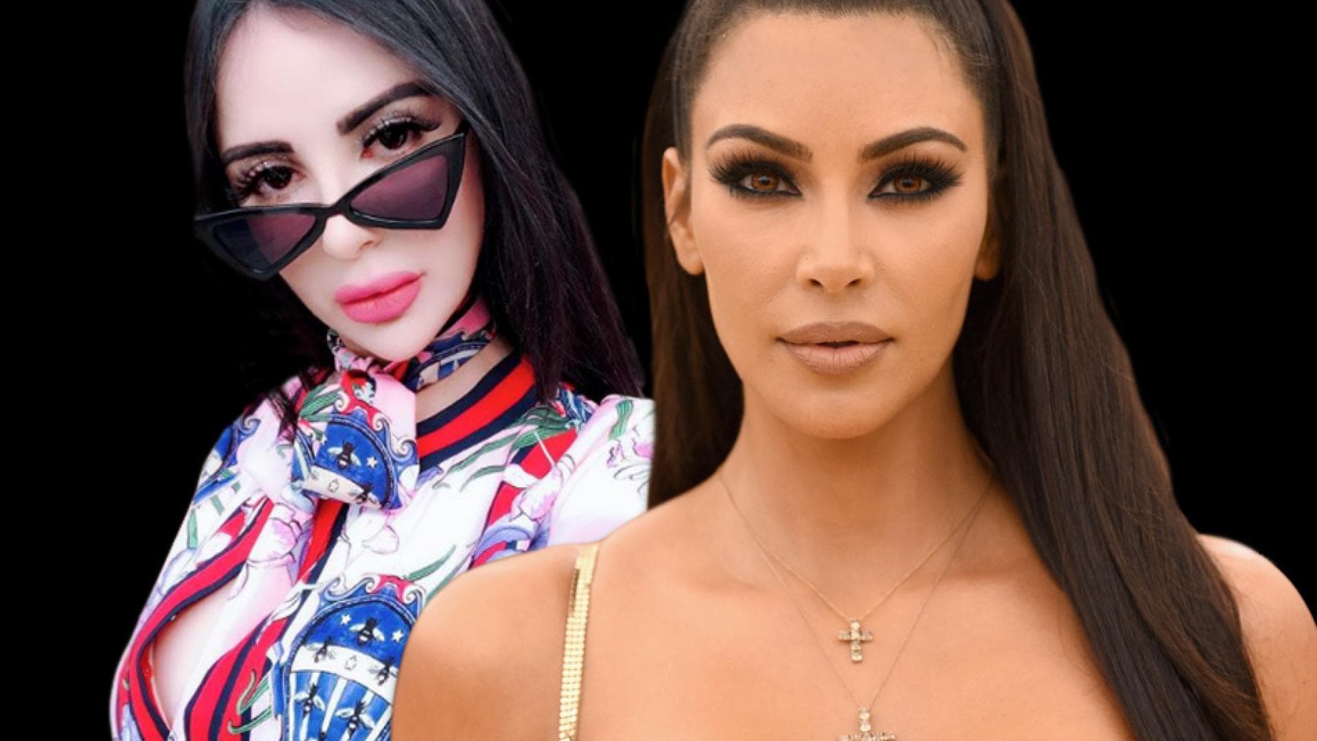 Ich Will Aussehen Wie Kim Kardashian Neun Ops In 24 Stunden