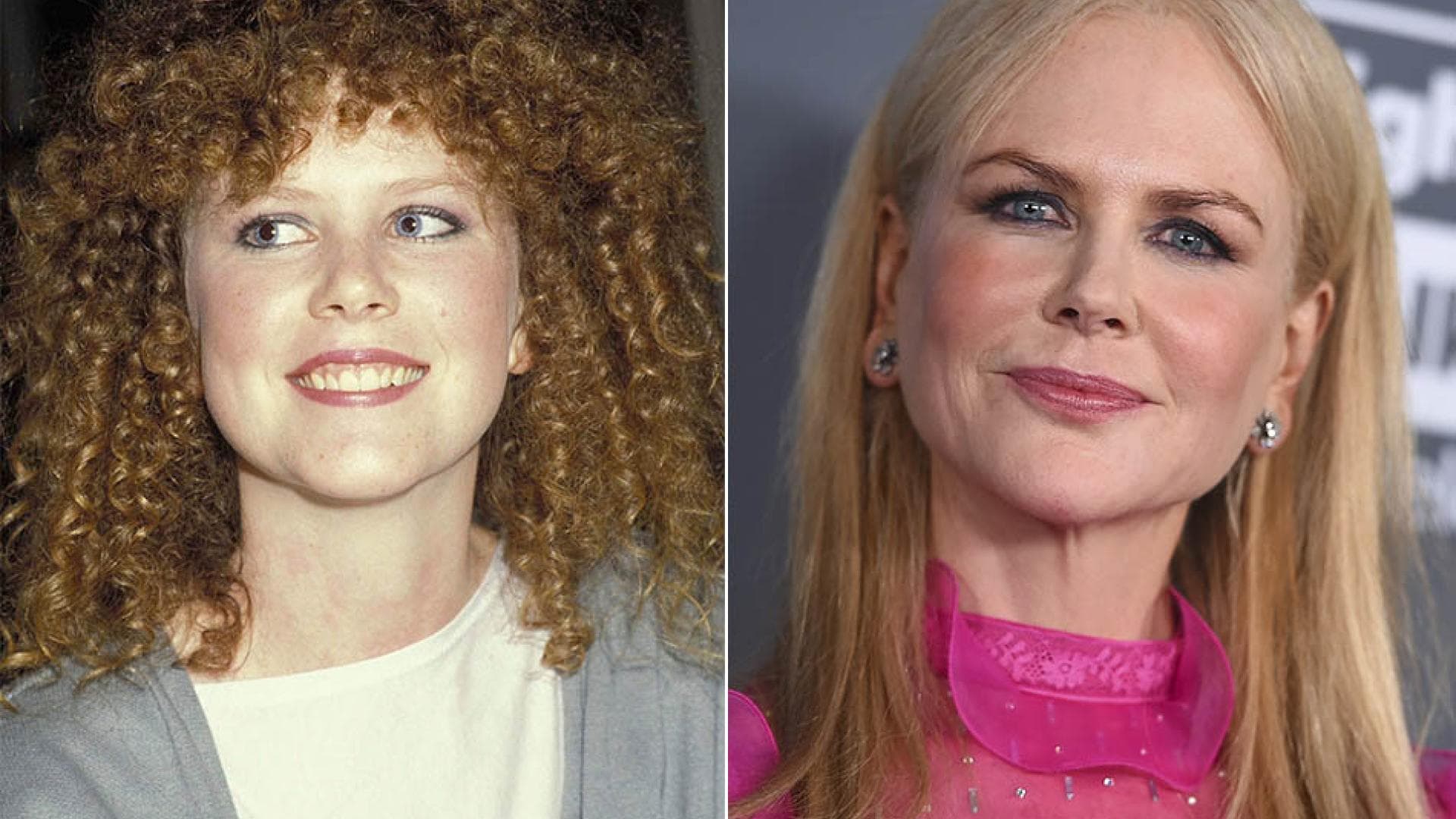 Nicole Kidman Was Ist Bloss Mit Ihrem Gesicht Passiert