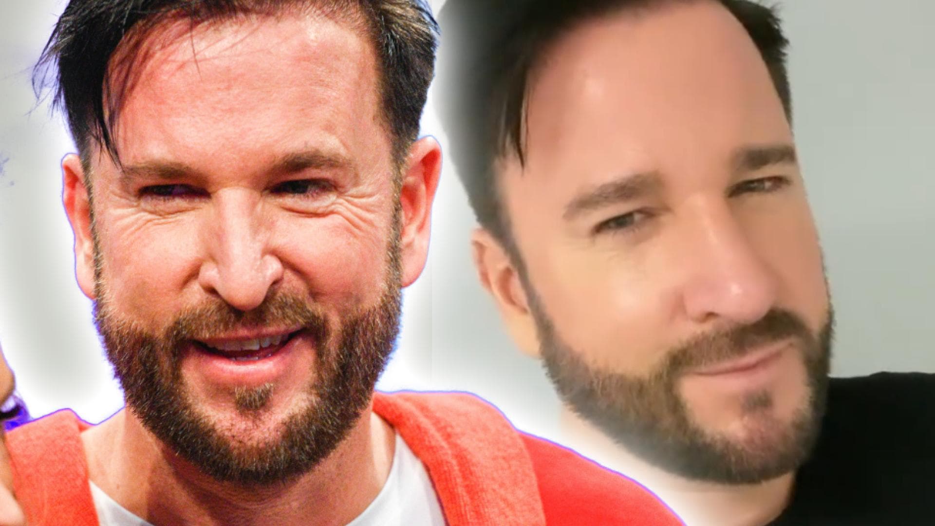 Michael Wendler Krasse Bilder Seiner Nasen Op