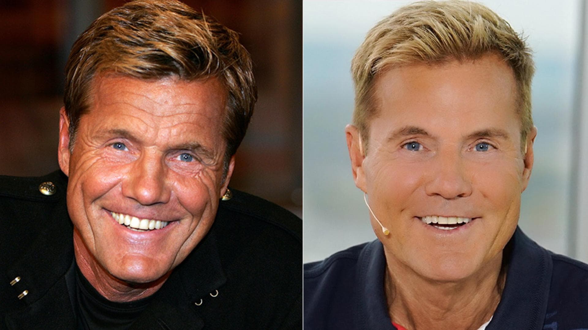 Dieter Bohlen: Was ist nur mit seinem Gesicht passiert?