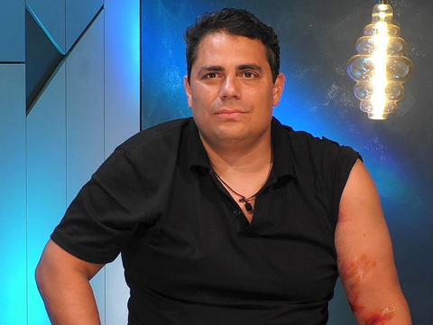 Silva Gonzalez mit einer Armverletzung bei "Prominent getrennt"