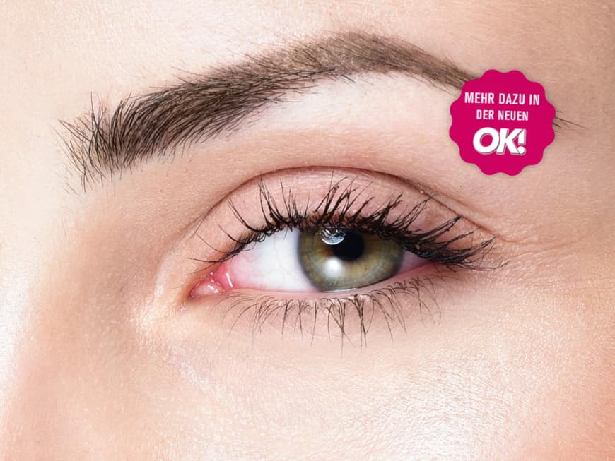 Beauty-Lexikon: Das hilft bei Schlupflidern