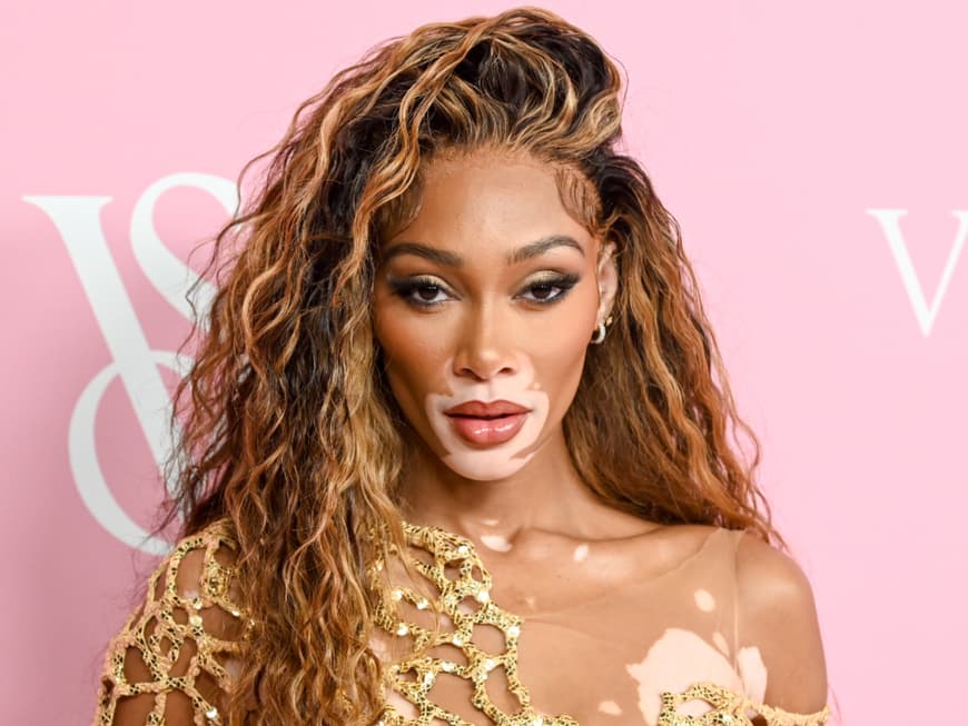 Winnie Harlow Was für eine Krankheit hat das Topmodel?