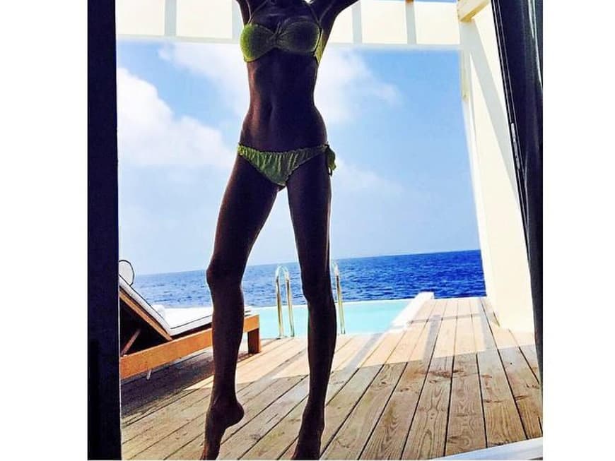 Mager Schock! Giulia Siegel zeigt sich knochig im Bikini