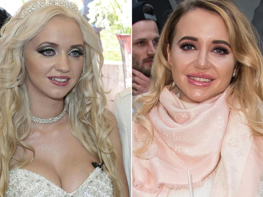 Die krassesten Beauty-Transformationen der Stars - Der radikale Vorher