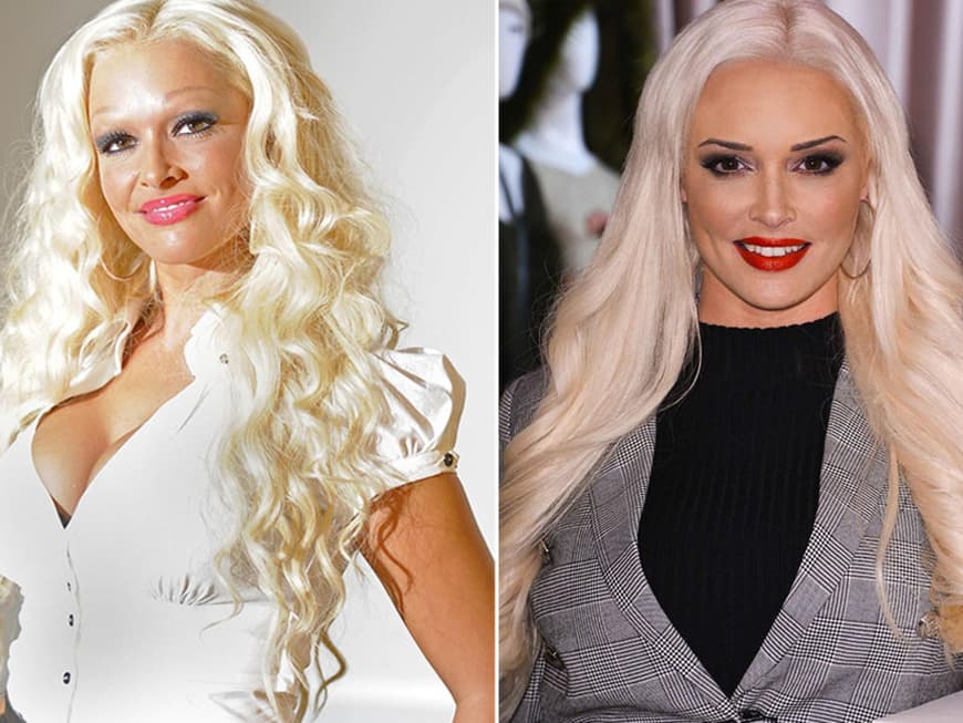 Pamela Anderson vorher und nachher