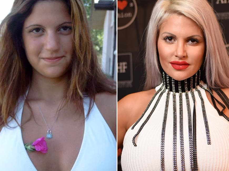 Pamela Anderson vorher und nachher