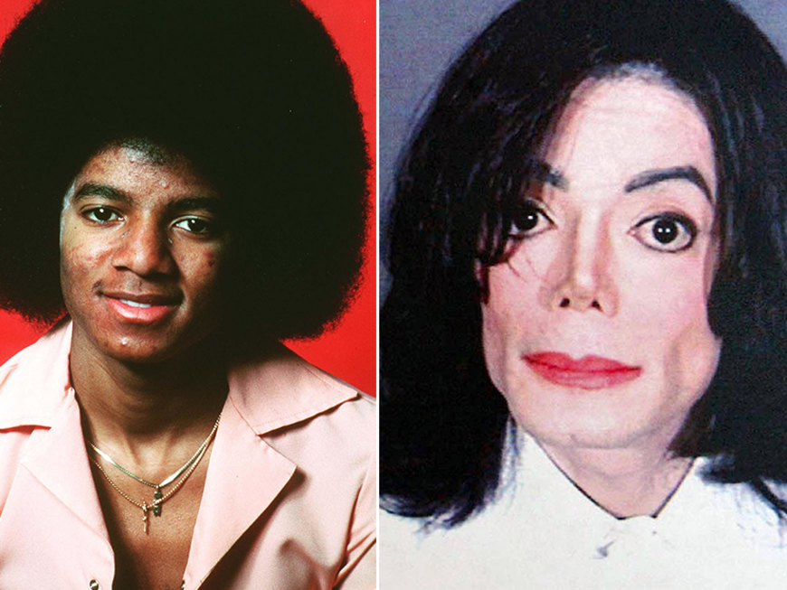 Michael Jackson früher und später