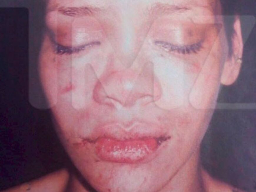 Die Sängerin erlitt schwere Verletzungen im Gesicht. Und nicht nur das, auch ihre Seele hat monatelang unter der brutalen Attacke ihres Ex-Freundes gelitten