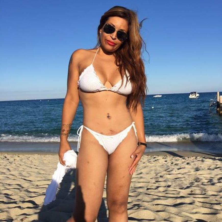 Am bikini narbe bauch