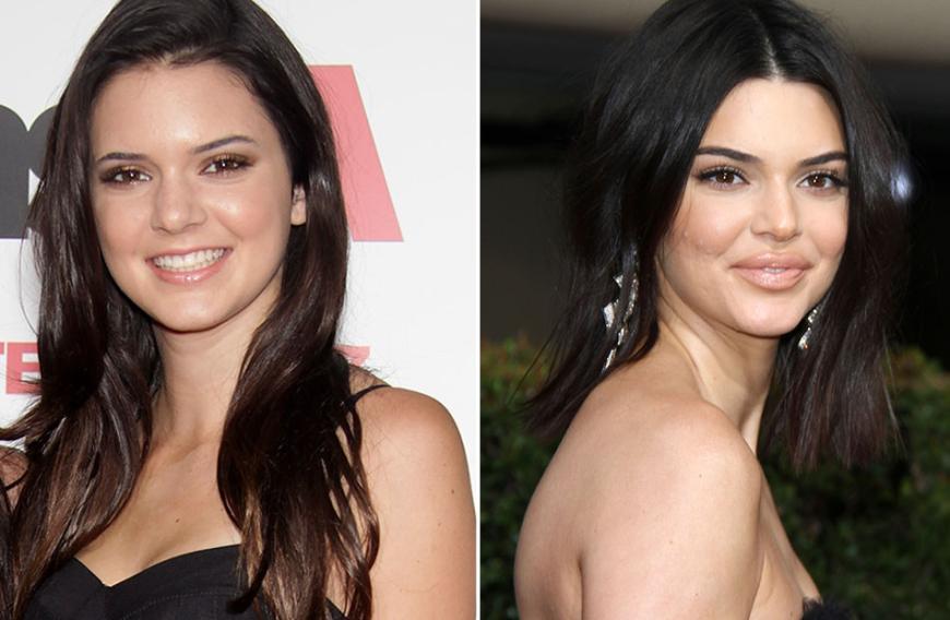Kendall Jenner 22 Gilt Als Die Krassesten Beauty