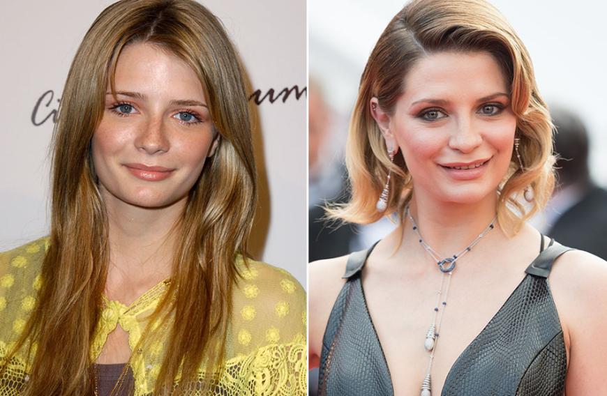 Die Krassesten Beauty Transformationen Der Stars Ok Magazin