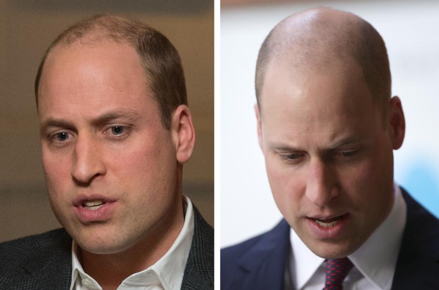 prinz william diese frisur hat uber