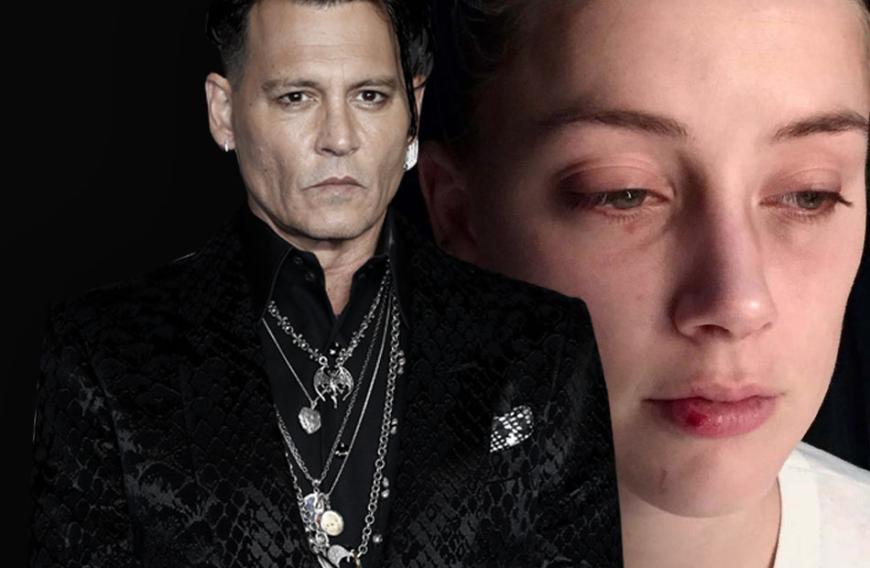 Amber Heard Prugel Fotos Hat Johnny Depp Sie So Zugerichtet