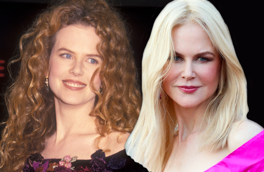 Nicole Kidman Was Ist Bloss Mit Ihrem Gesicht Passiert
