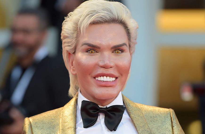 Op Wahnsinn Von Rodrigo Alves Fallt Der Real Life Ken Bald Auseinander